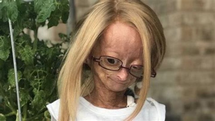 Adalia Rose - Trivia, Family, Bio