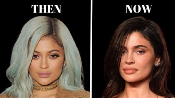 From Kylie Jenner to Lady Gaga to Kanye West use colored contact lenses! Know about the benefits and also precautions to be taken with use of them!