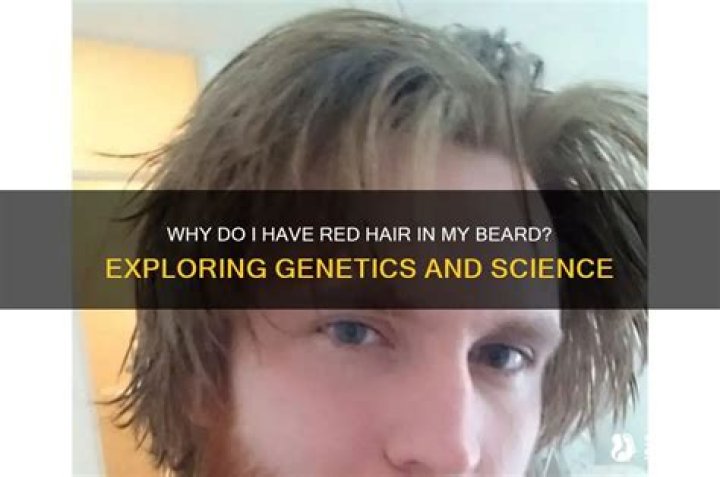 Why do I have red hair in my beard?