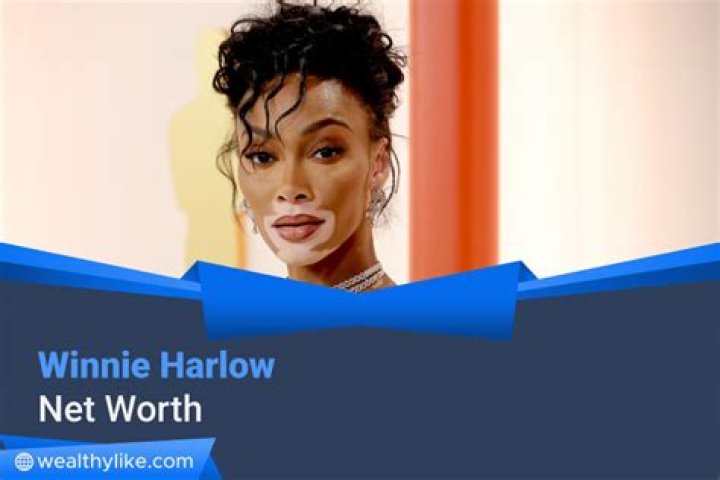 Winnie Harlow Net Worth - Wiki, Age, Weight and Height, Relationships, Family, and More